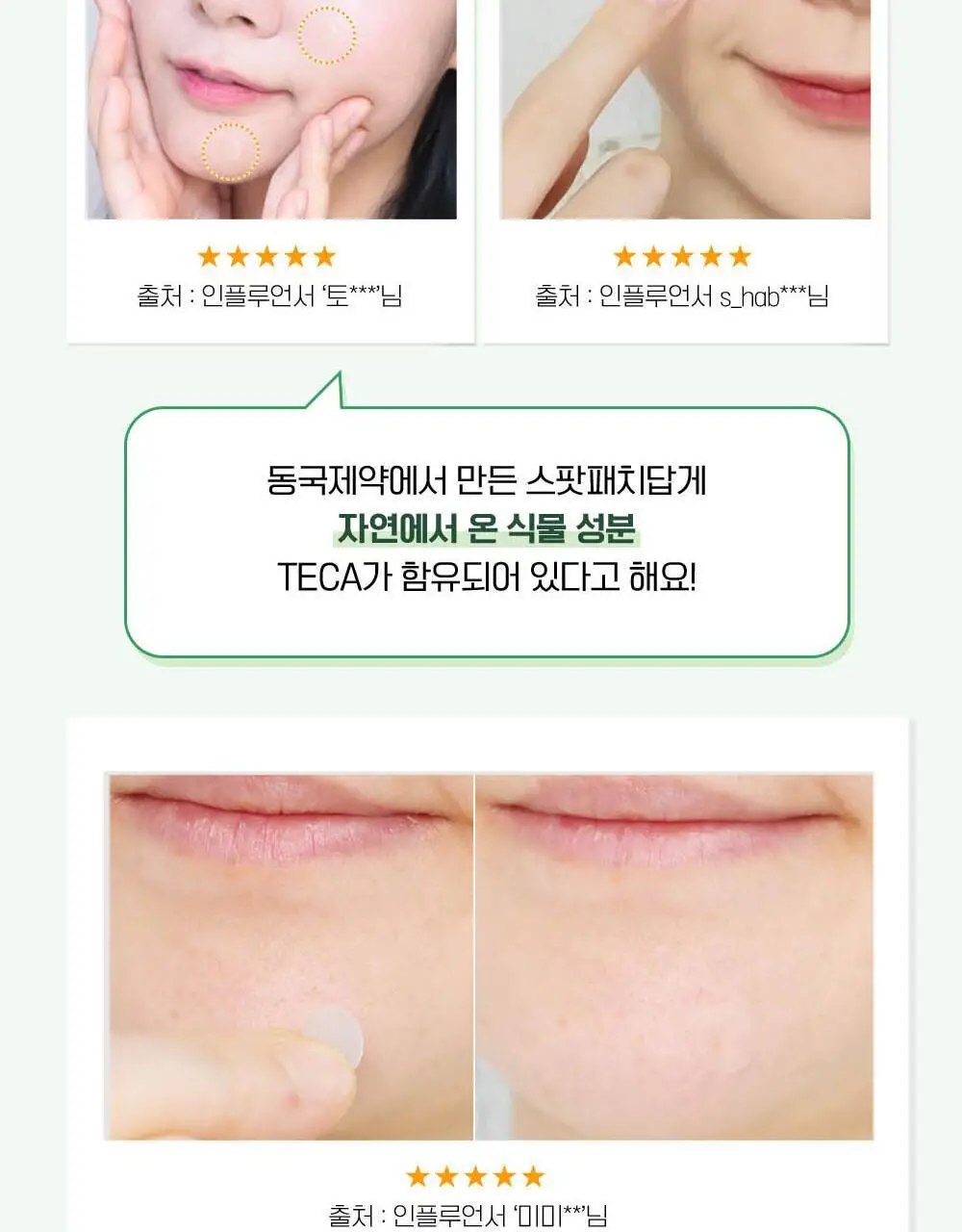 [단독기획] 마데카 메디패치 스팟패치 (33매/99매) 상세페이지 6
